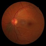 retina.jpg